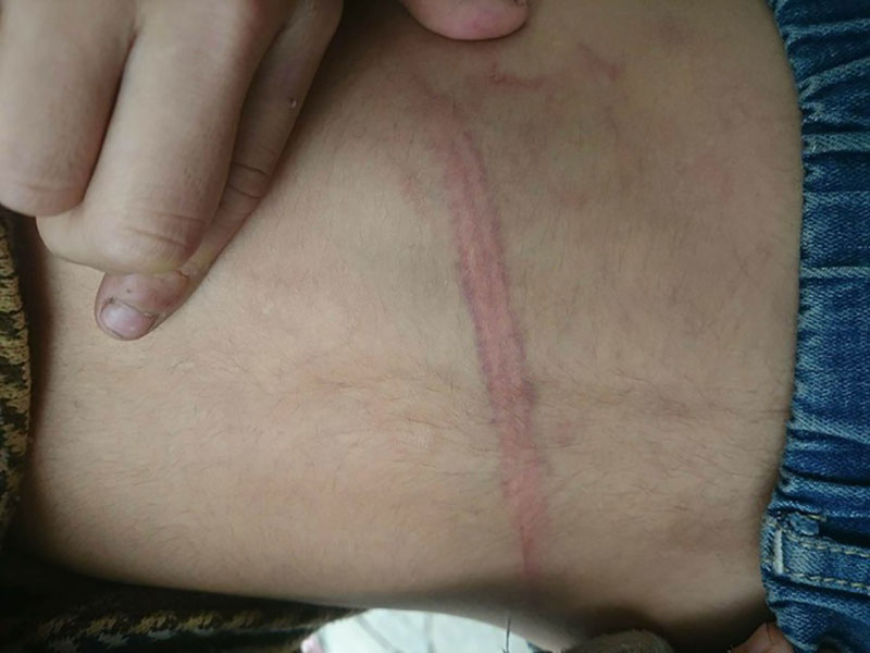 Chủ tịch thành phố Hà Nội yêu cầu làm rõ vụ bé trai 9 tuổi bị bố đẻ dùng dây điện đánh đập dã man Chủ tịch thành phố Hà Nội yêu cầu làm rõ vụ bé trai 9 tuổi bị bố đẻ dùng dây điện đánh đập dã man
